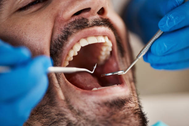 Best Weekend Emergency Dental Services in Marlow, OK